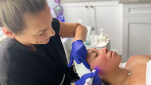 Unlocking Radiant Skin: Is a HydraFacial Right for You?